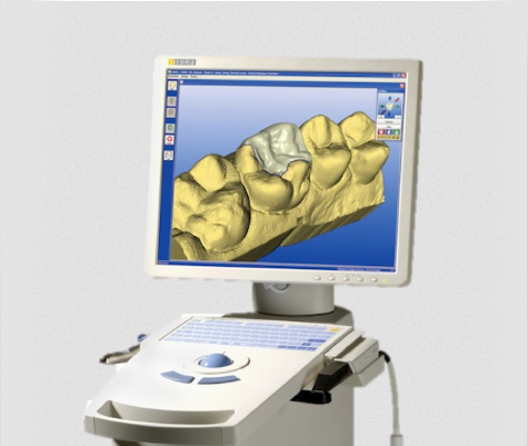 CEREC in Bethesda, MD