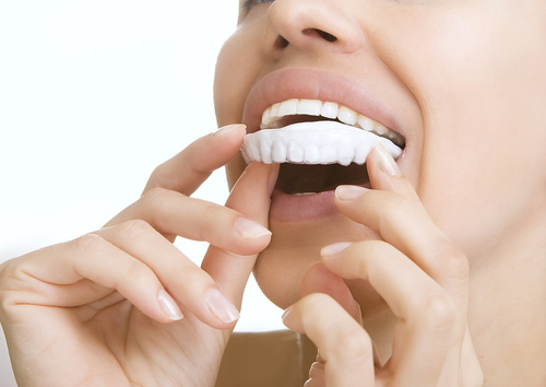 Professional Teeth Whitening in Bethesda, MD